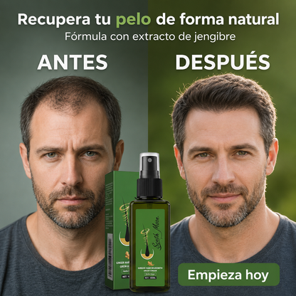 Spray para el Crecimiento del Pelo-Crevix
