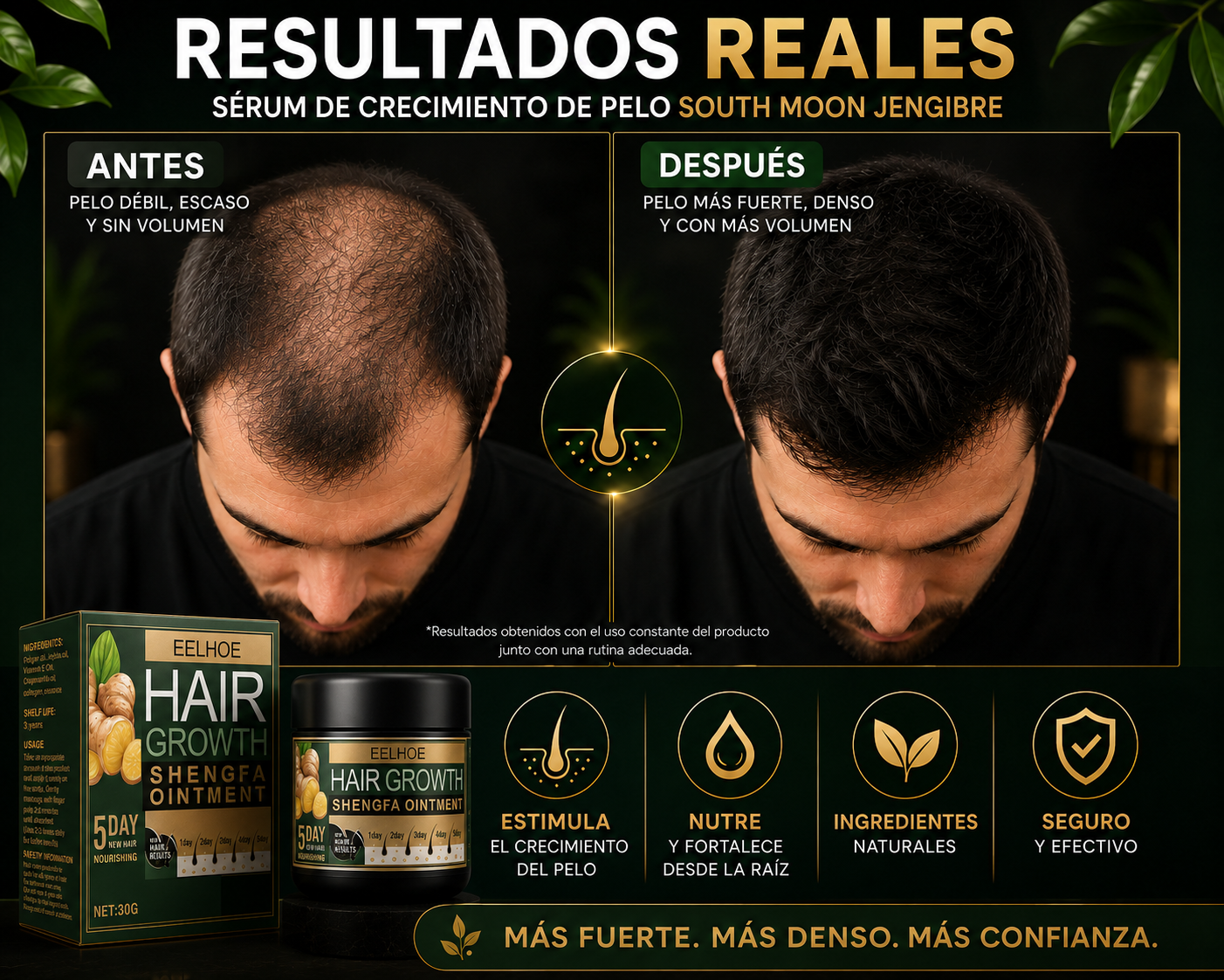 EELHOE Hair Growth Crema de jengibre - crece cabello
