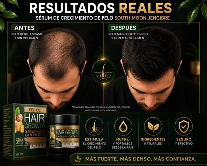 EELHOE Hair Growth Crema de jengibre - crece cabello